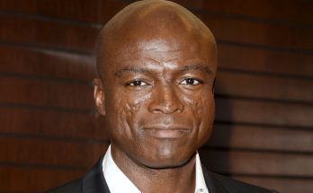 Why Singer Seal Has Scars on His Face - 3 Pics of What He Would Look Like without Them