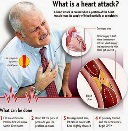 Heart Attack Symptoms, Causes, And What To Do